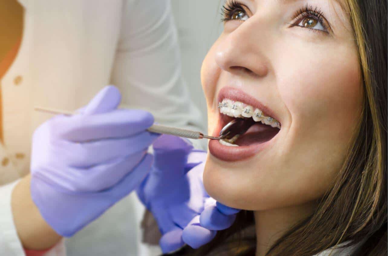 A woman with metal braces undergoes a dental cleaning.